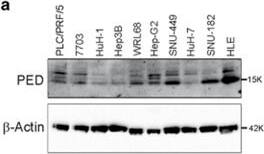 Detection of Human PEA-15 by Western Blot