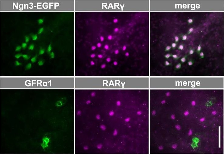 Detection of Mouse GFR alpha-1/GDNF R alpha-1 by Immunocytochemistry/ Immunofluorescence
