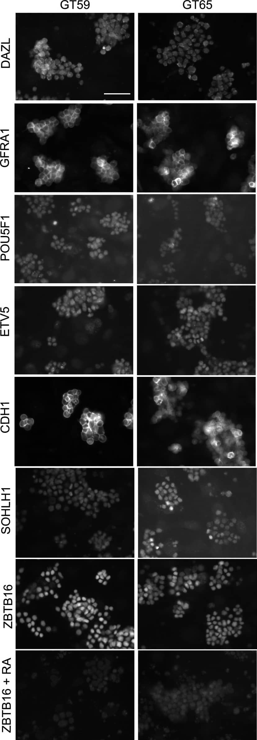 Detection of Mouse GFR alpha-1/GDNF R alpha-1 by Immunocytochemistry/ Immunofluorescence