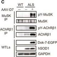 Detection of Mouse MuSK by Western Blot