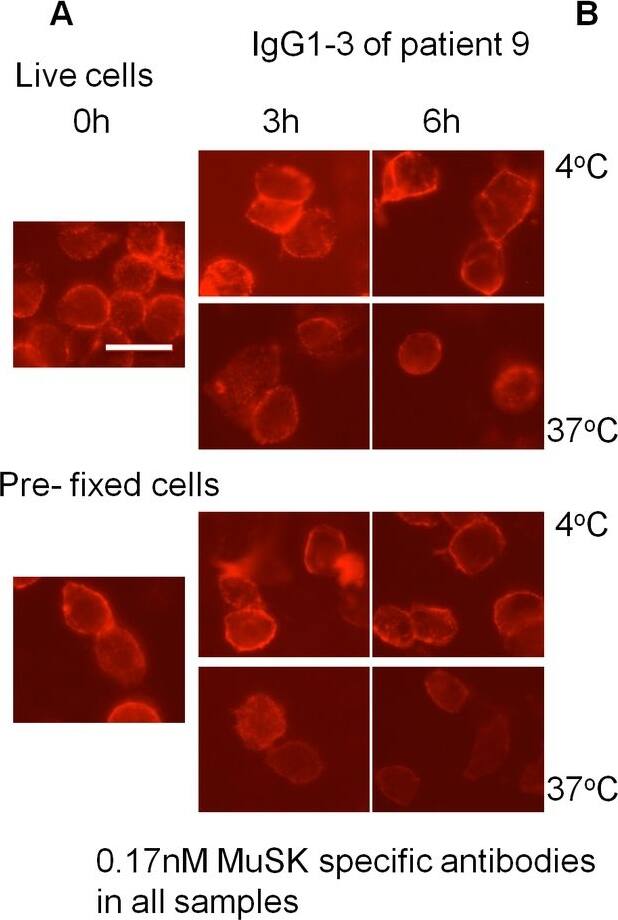 Detection of Human MuSK by Immunocytochemistry/ Immunofluorescence