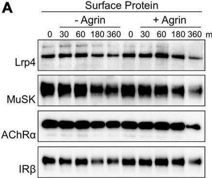 Detection of MuSK by Western Blot