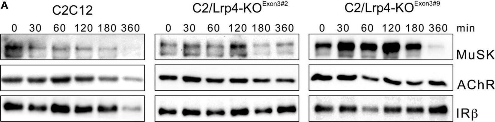 Detection of MuSK by Western Blot