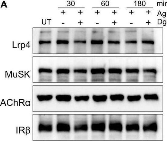 Detection of MuSK by Western Blot