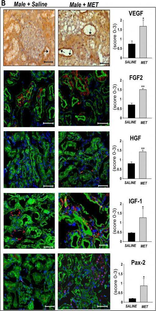 Detection of Rat VEGF by Immunohistochemistry