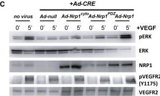 Detection of Neuropilin-1 by Western Blot