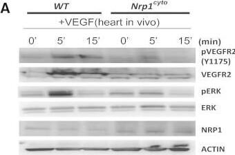 Detection of Neuropilin-1 by Western Blot