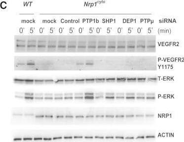 Detection of Neuropilin-1 by Western Blot
