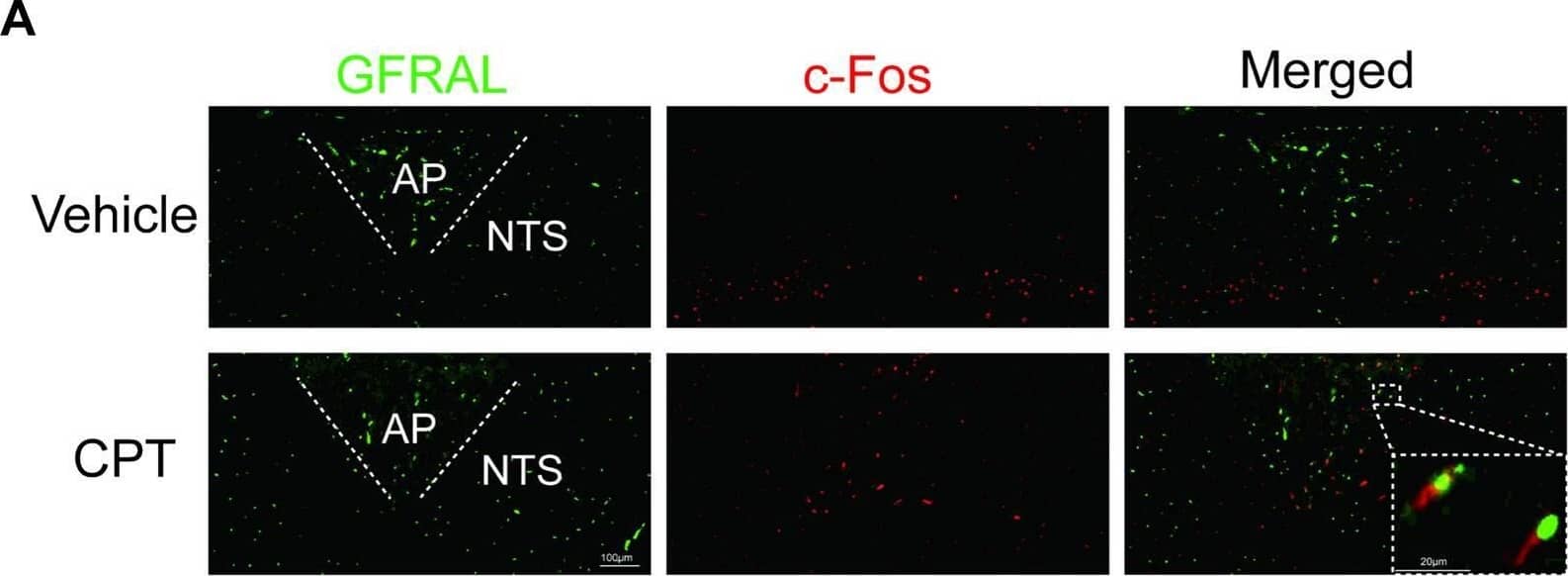 Detection of GFR alpha -like by Immunocytochemistry/ Immunofluorescence