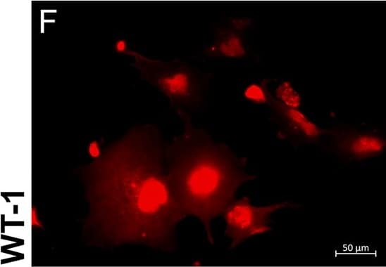 Detection of Human WT1 by Immunocytochemistry/Immunofluorescence