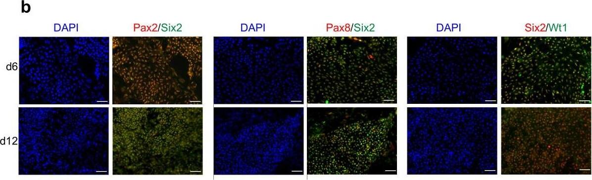 Detection of Human WT1 by Immunocytochemistry/Immunofluorescence