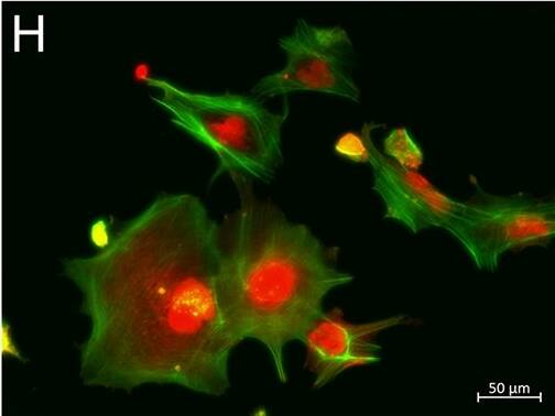 Detection of Human WT1 by Immunocytochemistry/Immunofluorescence