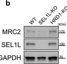 Detection of Mrc2 by Western Blot