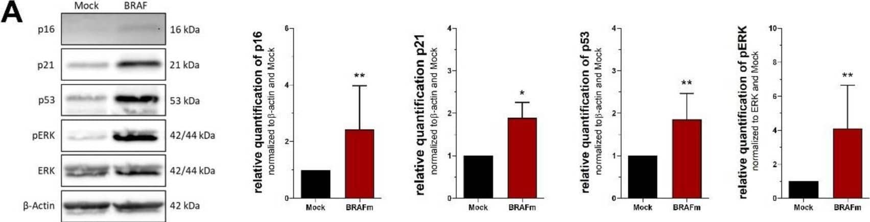 Detection of p16INK4a/ CDKN2A by Western Blot