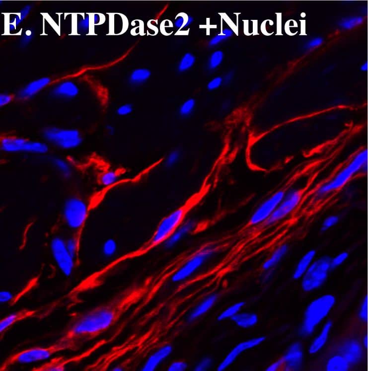 Detection of Mouse CD39L1/ENTPD2 by Immunocytochemistry/Immunofluorescence