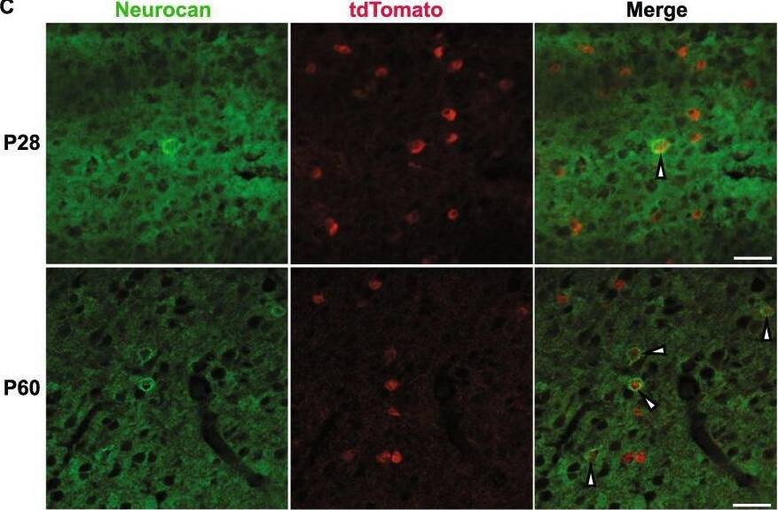 Detection of Neurocan by Immunohistochemistry