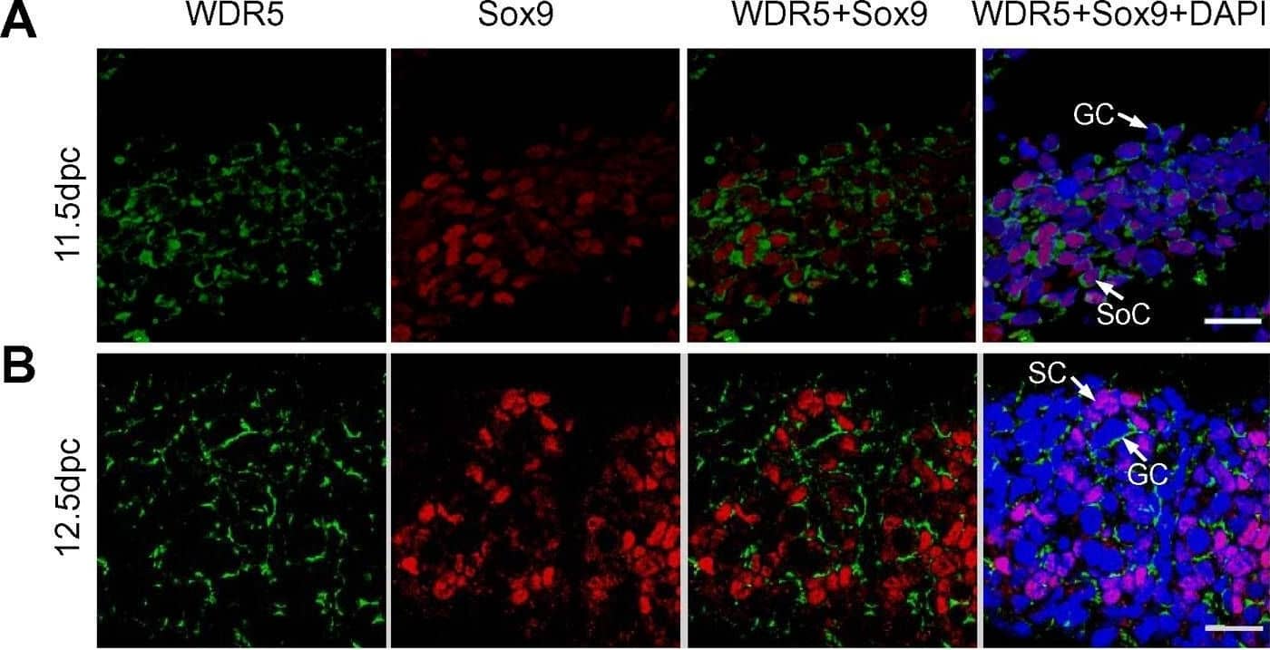 Detection of WDR5 by Immunohistochemistry