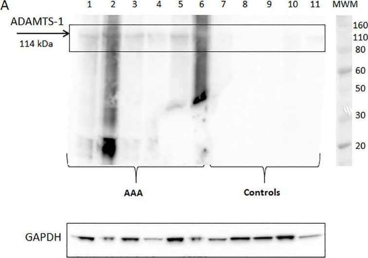 Detection of Human ADAMTS1 by Western Blot