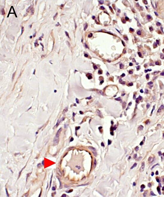 Detection of Human ADAMTS1 by Immunocytochemistry/Immunofluorescence
