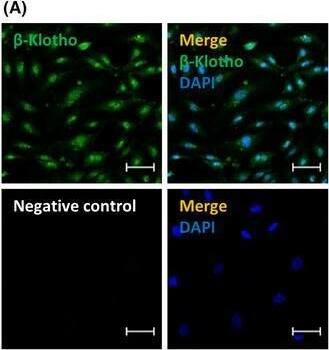 Detection of Klotho  beta by Immunocytochemistry/ Immunofluorescence