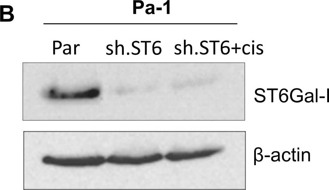 Detection of Human Human ST6 Gal Sialyltransferase 1/ ST6GAL1 Antibody by Western Blot