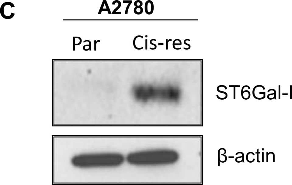Detection of Human ST6 Gal Sialyltransferase 1/ST6GAL1/CD75 by Western Blot
