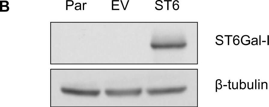 Detection of Human ST6 Gal Sialyltransferase 1/ST6GAL1/CD75 by Western Blot