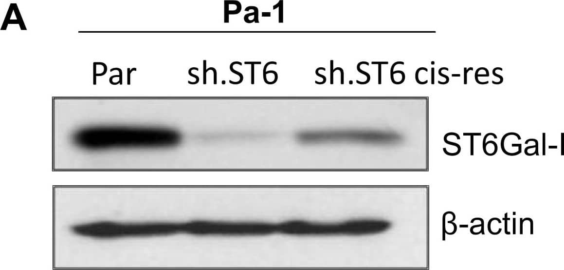 Detection of Human ST6 Gal Sialyltransferase 1/ST6GAL1/CD75 by Western Blot