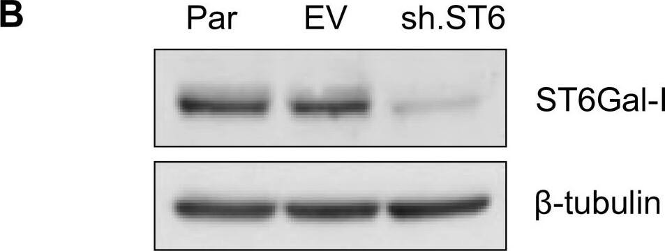 Detection of Human ST6 Gal Sialyltransferase 1/ST6GAL1/CD75 by Western Blot