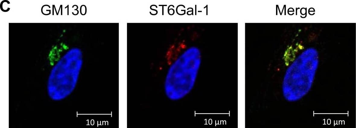 Detection of Human ST6 Gal Sialyltransferase 1/ST6GAL1/CD75 by Immunocytochemistry/Immunofluorescence