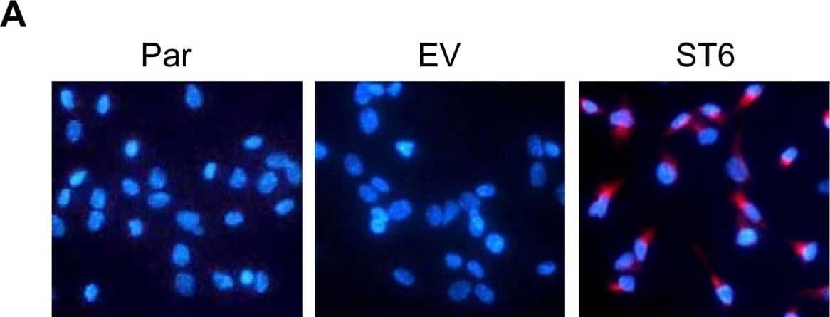 Detection of Human ST6 Gal Sialyltransferase 1/ST6GAL1/CD75 by Immunocytochemistry/Immunofluorescence