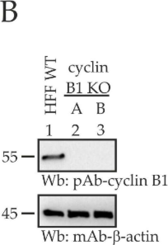 Detection of Cyclin B1 by Western Blot