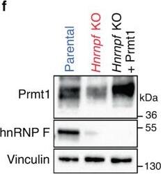 Detection of PRMT1 by Western Blot