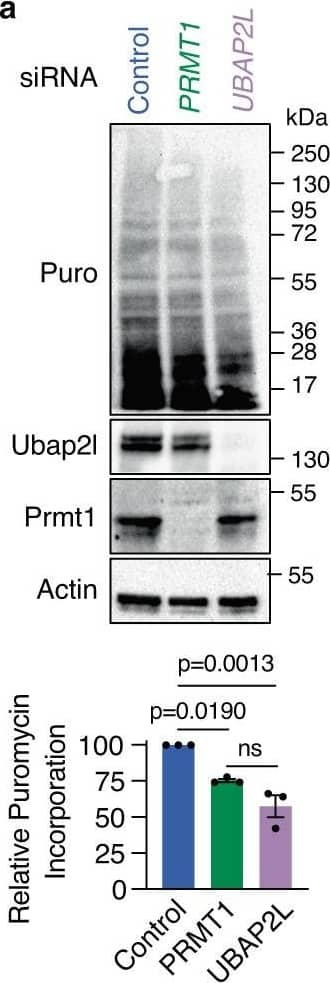 Detection of PRMT1 by Western Blot