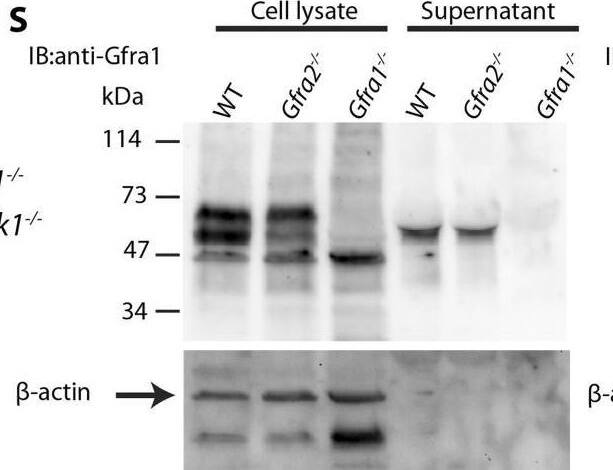 Detection of GFR alpha-2/GDNF R alpha-2 by Western Blot