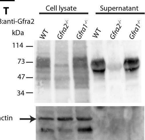 Detection of GFR alpha-2/GDNF R alpha-2 by Western Blot