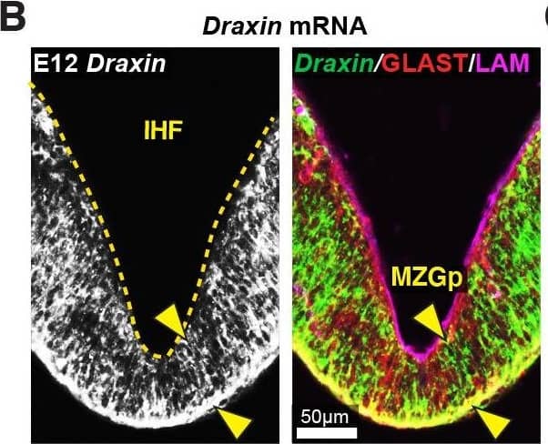 Detection of Mouse Draxin/C1orf187 by Immunohistochemistry