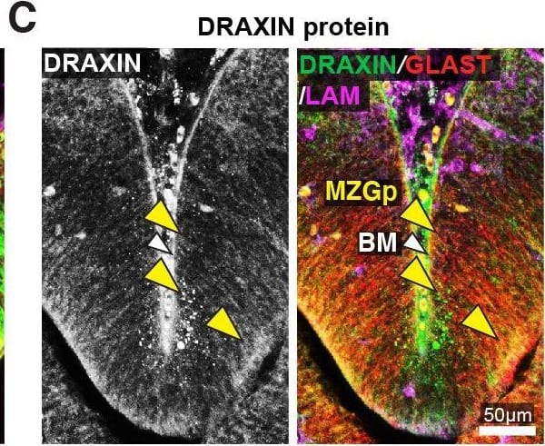 Detection of Mouse Draxin/C1orf187 by Immunohistochemistry