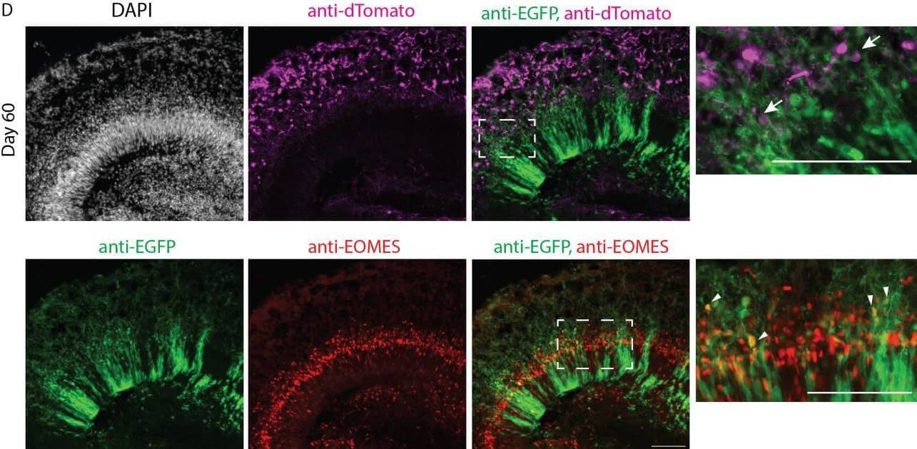 Detection of EOMES by Immunohistochemistry
