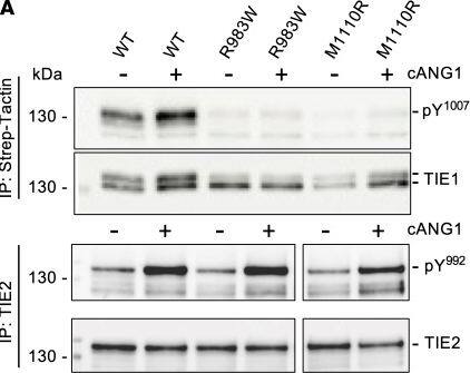 Detection of Tie-1 by Western Blot