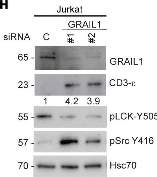 Detection of Human GRAIL/RNF128 by Western Blot