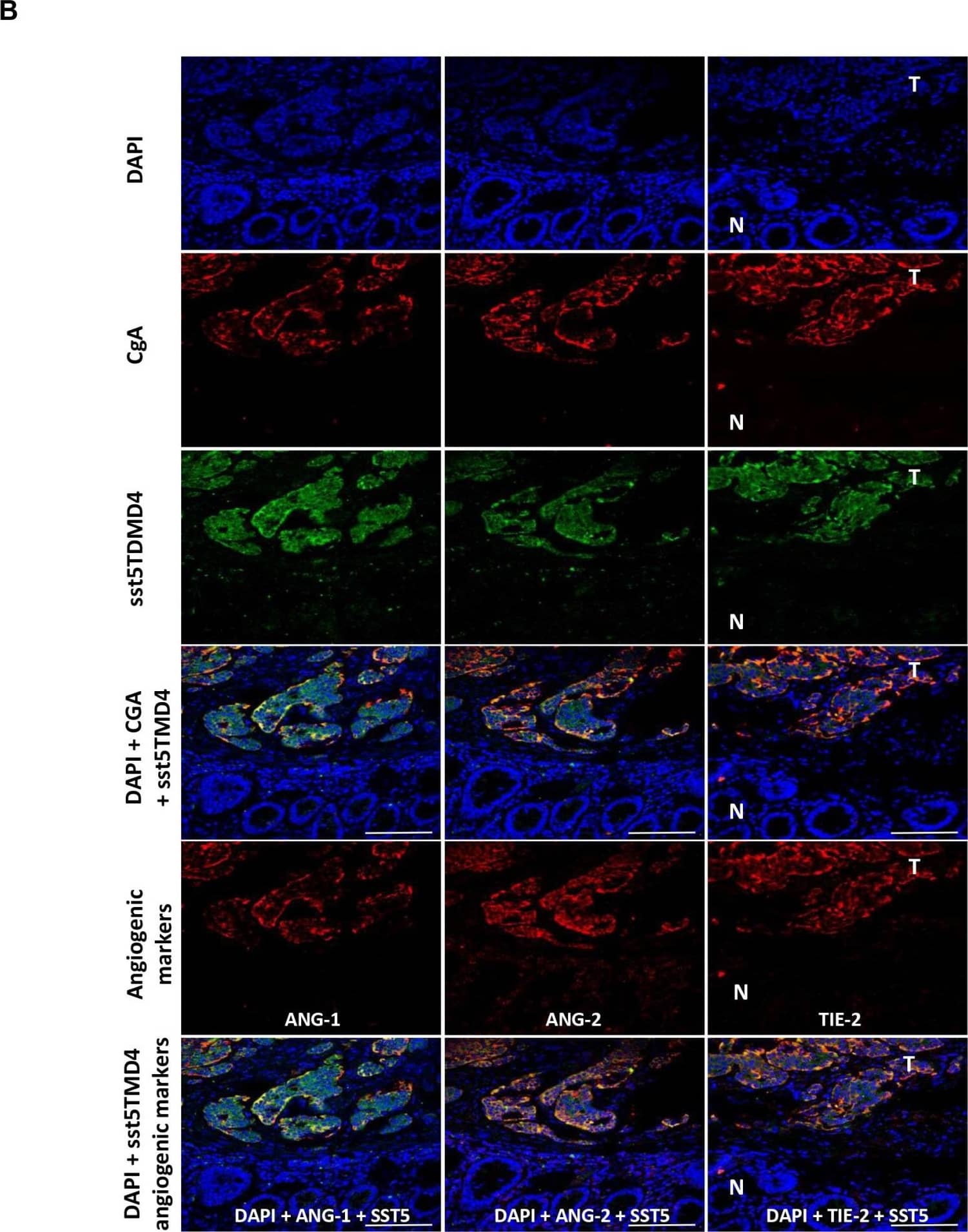 Detection of Human Angiopoietin-2 by Immunohistochemistry