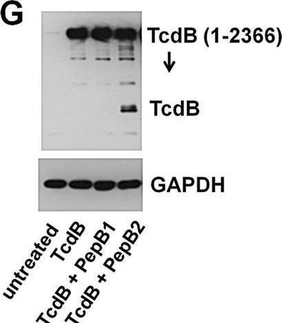 Detection of C. difficile Toxin B/TcdB by Western Blot