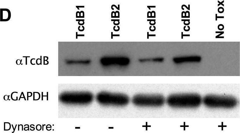 Detection of C. difficile Toxin B/TcdB by Western Blot