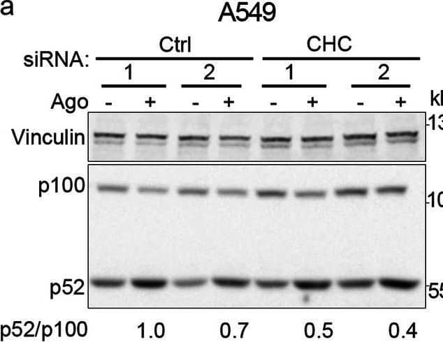 Detection of Lymphotoxin  betaR/TNFRSF3 by Western Blot