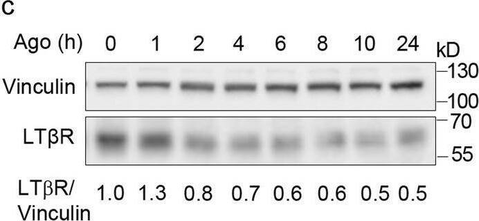 Detection of Lymphotoxin  betaR/TNFRSF3 by Western Blot