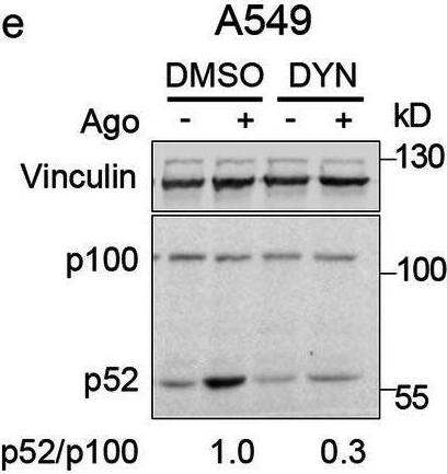 Detection of Lymphotoxin  betaR/TNFRSF3 by Western Blot