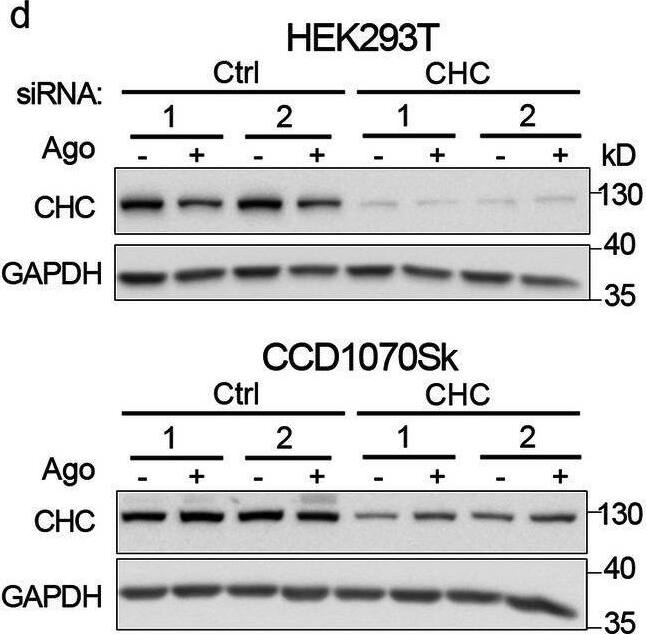 Detection of Lymphotoxin  betaR/TNFRSF3 by Western Blot