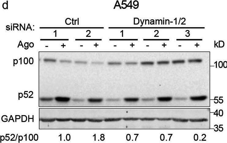 Detection of Lymphotoxin  betaR/TNFRSF3 by Western Blot