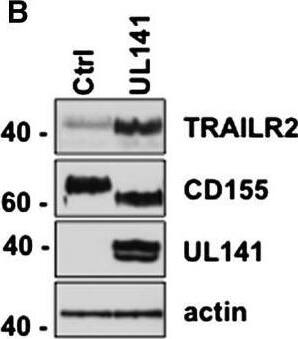 Detection of Human TRAIL R2/TNFRSF10B by Western Blot